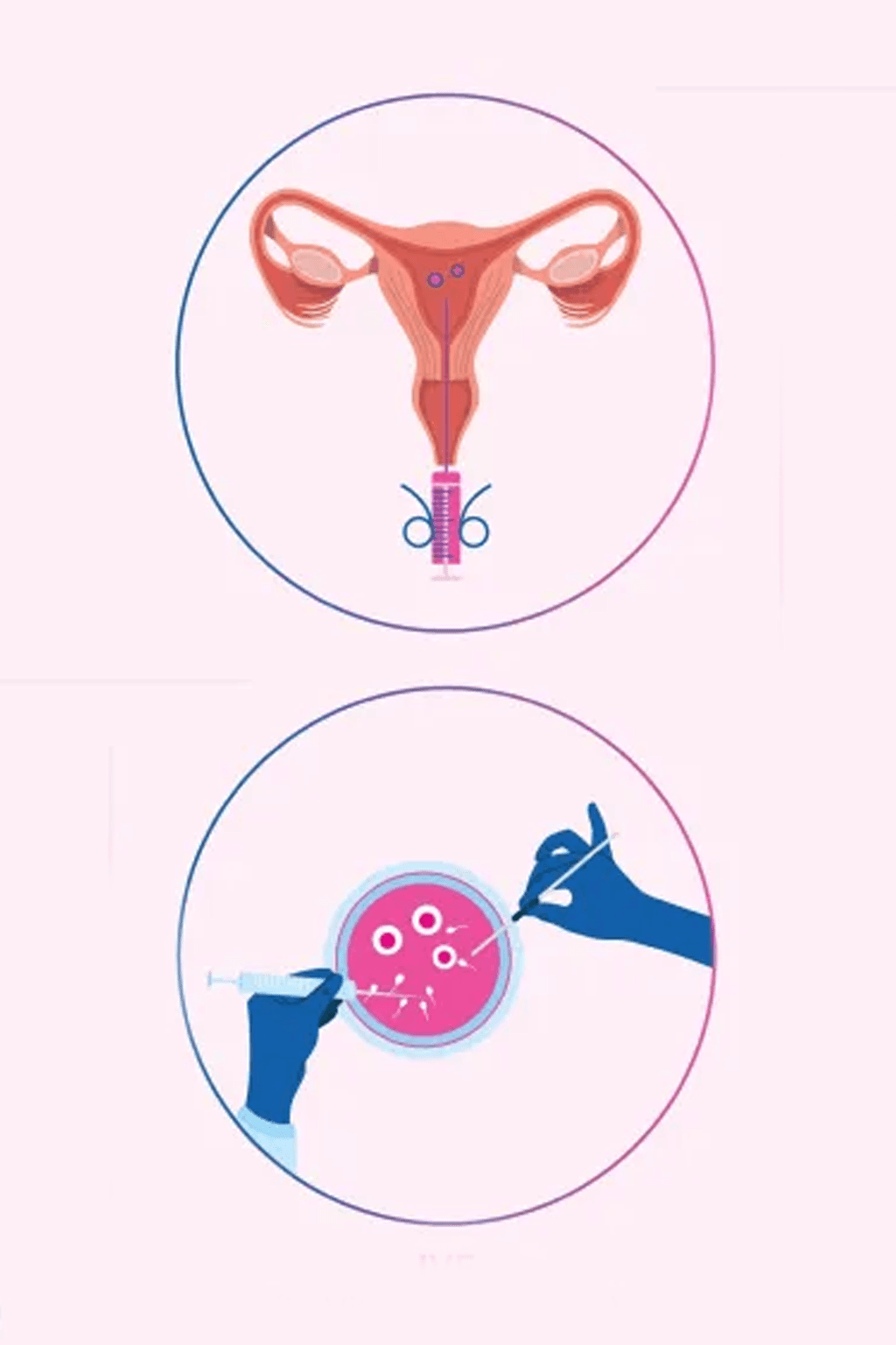 IUI & IVF service at Arogya Hospital
